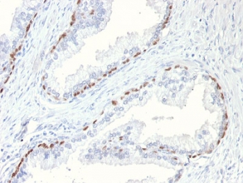 IHC testing of FFPE mouse prostate with p63 anti