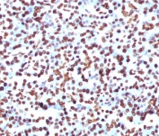 IHC staining of FFPE human pancreas with SOX9 antibody (clone SRYB9-1). HIER: boil tissue sections in pH 9 10mM Tris with 1mM EDTA for 10-20 min followed by cooling at RT for 20 min.