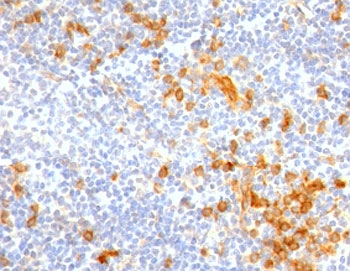 IHC staining of FFPE human tonsil with IL3RA antibody (clone CDLA123-1R). HIER: boil tissue sections in 10mM Tris with 1mM EDTA, pH 9 for 10-20 min and allow to cool.~