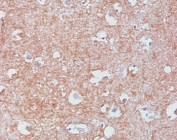 IHC staining of human cerebellum with recombinant NF-L antibody (clone MSI27-2R). HIER: boil tissue sections in pH 9 10mM Tris with 1mM EDTA for 10-20 min and allow to cool before testing.