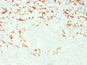 IHC testing of FFPE human lymph node with CD163 antibody (clone M130/2164). HIER: boil tissue sections in 10mM Tris with 1mM EDTA, pH 9 for 10-20 min followed by cooling at RT for 20 min.