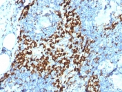 IHC testing of FFPE human lymph node with CD163 antibody (clone M130/2164). HIER: boil tissue sections in 10mM Tris with 1mM EDTA, pH 9 for 10-20 min followed by cooling at RT for 20 min.