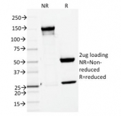 SDS-PAGE analysis of purified, BSA-free ENAH antibody as confirmation of integrity and purity.