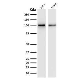 Western blot testing of human HeLa and MCF-7 lysate with ENAH antibody. Predicted molecular weight ~66 kDa but can be observed at ~90 kDa.~