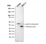 Western blot testing of human samples with Cathepsin D antibody (clone CTSD/2781).