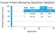 Analysis of HuProt(TM) microarray containing more than 19,000 full-length human proteins using Cathepsin K antibody (clone CTSK/2791). These results demonstrate the foremost specificity of the CTSK/2791 mAb. Z- and S- score: The Z-score represents the strength of a signal that an antibody (in combination with a fluorescently-tagged anti-IgG secondary Ab) produces when binding to a particular protein on the HuProt(TM) array. Z-scores are described in units of standard deviations (SD's) above the mean value of all signals generated on that array. If the targets on the HuProt(TM) are arranged in descending order of the Z-score, the S-score is the difference (also in units of SD's) between the Z-scores. The S-score therefore represents the relative target specificity of an Ab to its intended target.