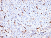 IHC testing of FFPE human liver tissue with Cathepsin K antibody (clone CTSK/2791). HIER: boil tissue sections in pH6, 10mM citrate buffer, for 10-20 min followed by cooling at RT for 20 min.