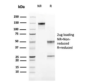 SDS-PAGE analysis of purified, BSA-free Cathepsin K antibody (clone CTSK/2791) as confirmation of integrity and purity.