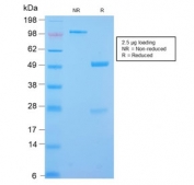 SDS-PAGE analysis of purified, BSA-free Desmin antibody (clone DES/2960R) as confirmation of integrity and purity.