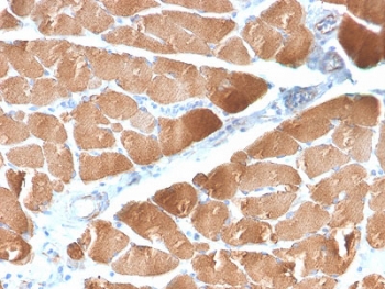 IHC testing of FFPE human skeletal muscle with recombinant Desmin antibody (clone DES/2960R). Required HIER: boil tissue sections in 10mM Tris with 1mM EDTA, pH 9 for 10-20 min and allow to cool before testing.~