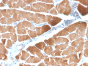 Desmin Antibody Skeletal Muscle IHC. Immunohistochemical analysis of Desmin in formalin-fixed, paraffin-embedded human skeletal muscle tissue using Desmin antibody clone DES/2960R. Strong cytoplasmic staining is observed in muscle fibers, consistent with Desmin localization within the intermediate filament network of muscle cells, supporting its role as a muscle structural marker.
