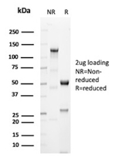 Desmin Antibody SDS-PAGE (Reducing vs Non-Reducing). SDS-PAGE analysis of Desmin antibody clone DES/2960R under non-reducing (NR) and reducing (R) conditions. Under reducing conditions, bands corresponding to antibody heavy chain (~50-55 kDa) and light chain (~25 kDa) are observed. Differences between NR and R conditions reflect expected changes in antibody structure during reduction.