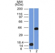 Western blot testing of 1) human partial protein and 2) human kidney lysate with AMACR antibody. Predicted molecular weight ~43 kDa.