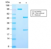 SDS-PAGE analysis of purified, BSA-free AMACR antibody (clone AMACR/2748R) as confirmation of integrity and purity.