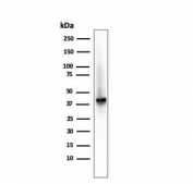 Western blot testing of human kidney lysate with recombinant AMACR antibody. Predicted molecular weight ~43 kDa.