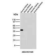 Recombinant AMACR Antibody Kidney Tissue WB. Western blot analysis of human, mouse, rat, hamster, and guinea pig kidney tissue lysates using AMACR Antibody clone AMACR/2748R demonstrates a distinct band at approximately 40-42 kDa selectively in human kidney lysate, consistent with the predicted molecular weight of Alpha-methylacyl-CoA racemase / AMACR. The observed species-selective reactivity pattern suggests preferential recognition of the human AMACR epitope by clone AMACR/2748R.