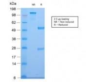 SDS-PAGE analysis of purified, BSA-free recombinant CELA3B antibody (clone CELA3B/2810R) as confirmation of integrity and purity.
