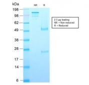 SDS-PAGE analysis of purified, BSA-free recombinant GH antibody (clone rGH/1450) as confirmation of integrity and purity.
