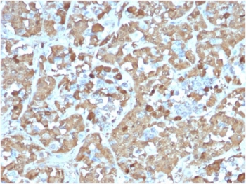 IHC testing of FFPE human pituitary gland with recombinant GH antibody (clone rGH/1450). Required HIER: boil tissue sections in pH 9 10mM Tris with 1mM EDTA for 10-20 min.~