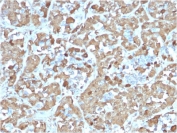 IHC testing of FFPE human pituitary gland with recombinant GH antibody (clone rGH/1450). Required HIER: boil tissue sections in pH 9 10mM Tris with 1mM EDTA for 10-20 min.
