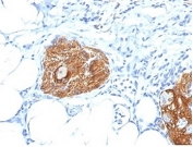IHC staining of FFPE human pancreas tissue with CD56 antibody (clone 56C04/123A8). HIER: boil tissue sections in pH9 EDTA buffer for 10-20 min followed by cooling at RT for 20 min.
