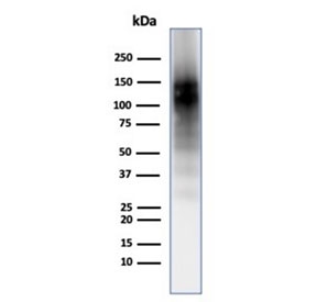 Western blot testing of human brain tissue with CD56 antibody (clone 56C04/123A8). Predicted molecular weight: ~110 kDa (soluble fragment), ~120/125 kDa (GPI-anchored), 140/180 kDa (transmembrane isoforms).