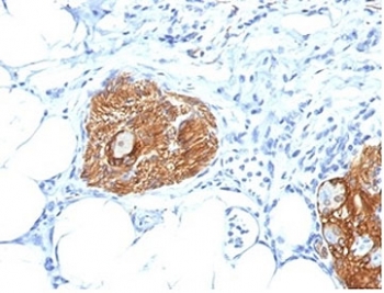 IHC staining of FFPE human pancreas tissue with CD56 antibody (clone 56C04/123A8). HIER: boil tissue sections in pH9 EDTA buffer for 10-20 min followed by cooling at RT for 20 min.~