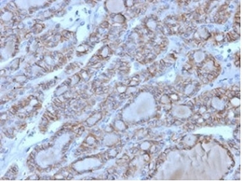 IHC staining of FFPE human thyroid tissue with CD56 ant