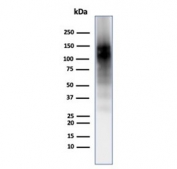 Western blot testing of human brain tissue with CD56 antibody. Predicted molecular weight: ~110 kDa (soluble fragment), ~120/125 kDa (GPI-anchored), 140/180 kDa (transmembrane isoforms).
