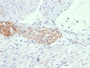 IHC staining of FFPE human colon tissue with CD56 antibody (clone 56C04/123A8). HIER: boil tissue sections in pH9 EDTA buffer for 10-20 min followed by cooling at RT for 20 min.