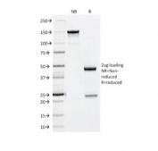 SDS-PAGE analysis of purified, BSA-free CD56 antibody (clone 56C04/123A8) as confirmation of integrity and purity.