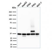 Western blot testing of human HeLa, HepG2, K562, A431 and MCF-7 cell lysate with RAD51 antibody (clone RAD51/2701). Expected molecular weight ~37 kDa.