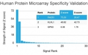 Analysis of HuProt(TM) microarray containing more than 19,000 full-length human proteins using RAD51 antibody (clone RAD51/2701). These results demonstrate the foremost specificity of the RAD51/2701 mAb. Z- and S- score: The Z-score represents the strength of a signal that an antibody (in combination with a fluorescently-tagged anti-IgG secondary Ab) produces when binding to a particular protein on the HuProt(TM) array. Z-scores are described in units of standard deviations (SD's) above the mean value of all signals generated on that array. If the targets on the HuProt(TM) are arranged in descending order of the Z-score, the S-score is the difference (also in units of SD's) between the Z-scores. The S-score therefore represents the relative target specificity of an Ab to its intended target.