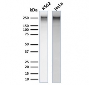 Western blot testing of human Hela and K562 cell lysate with recombinant Spectrin alpha 1 antibody (clone rSPTA1/1832). Expected molecular weight: 260-280 kDa.