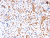 IHC staining of FFPE human placenta with Spectrin alpha 1 antibody (clone rSPTA1/1832). Required HIER: boil tissue sections in pH 9 10mM Tris with 1mM EDTA for 10-20 min followed by cooling at RT for 20 min.