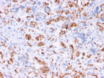 IHC staining of FFPE human placenta with Spectrin alpha 1 antibody (clone rSPTA1/1832). Required HIER: boil tissue sections in pH 9 10mM Tris with 1mM EDTA for 10-20 min followed by cooling at RT for 20 min.~