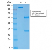 SDS-PAGE analysis of purified, BSA-free Spectrin alpha 1 antibody (clone rSPTA1/1832) as confirmation of integrity and purity.