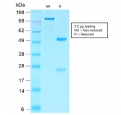 SDS-PAGE analysis of purified, BSA-free recombinant Villin antibody (clone VIL1/2310R) as confirmation of integrity and purity.