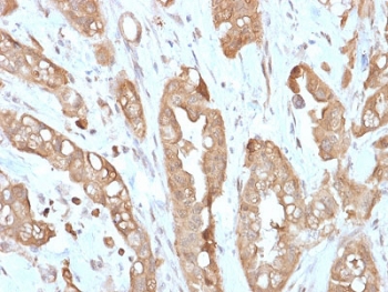 IHC testing of FFPE human small intestine with recombinant Villin antibody (clone VIL1/2310R). Required HIER: boil tissue sections in 10mM citrate buffer, pH 6, for 10-20 min followed by cooling at RT for 20 min.~