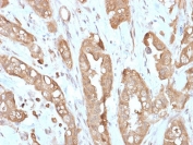 IHC testing of FFPE human small intestine with recombinant Villin antibody (clone VIL1/2310R). Required HIER: boil tissue sections in 10mM citrate buffer, pH 6, for 10-20 min followed by cooling at RT for 20 min.
