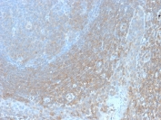 IHC staining of FFPE human tonsil with recombinant Bcl10 antibody (clone BL10/2988R). HIER: boil tissue sections in pH6, 10mM citrate buffer, for 10-20 min followed by cooling at RT for 20 min.
