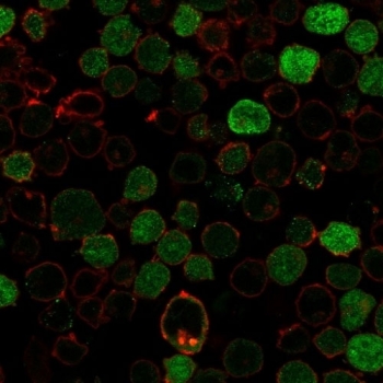 Immunofluorescent staining of PFA-fixed human K562 cells with recombinant Bcl10 antibody (clone BL10/2988R, green) and phalloidin (red).~