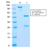 SDS-PAGE analysis of purified, BSA-free recombinant Bcl10 antibody (clone BL10/2988R) as confirmation of integrity and purity.