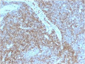 IHC staining of FFPE human lymph node with recombinant CD44 antibody (clone HCAM/2875R). HIER: boil tissue sections in pH 9 10mM Tris with 1mM EDTA for 10-20 min followed by cooling at RT for 20 min.~
