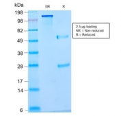 SDS-PAGE analysis of purified, BSA-free recombinant Nuclear Marker antibody (clone NM2984R) as confirmation of integrity and purity.