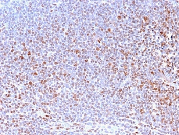 IHC staining of FFPE human tonsil with Nuclear Marker antibody (clone NM2984R). HIER: boil tissue sections in pH6, 10mM citrate buffer, for 10-20 min and allow to cool prior to testing.~