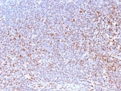 IHC staining of FFPE human tonsil with Nuclear Marker antibody (clone NM2984R). HIER: boil tissue sections in pH6, 10mM citrate buffer, for 10-20 min and allow to cool prior to testing.