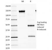 SDS-PAGE analysis of purified, BSA-free GAD65 antibody (clone GAD2/2362) as confirmation of integrity and purity.