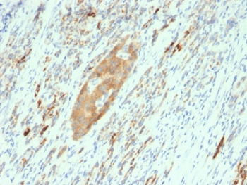 IHC testing of FFPE human pancreas with GAD65 antibody (clone GAD2/2362). Required HIER: boil tissue sections in 10mM citrate buffer, pH 6, for 10-20 min and allow to cool prior to testing.~