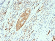IHC testing of FFPE human pancreas with GAD65 antibody (clone GAD2/2362). Required HIER: boil tissue sections in 10mM citrate buffer, pH 6, for 10-20 min and allow to cool prior to testing.